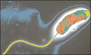 Βακτήριο χολέρας Βακτήριο χολέρας