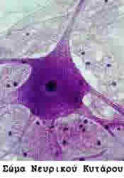 Σώμα νευρικού κυττάρου Σώμα νευρικού κυττάρου