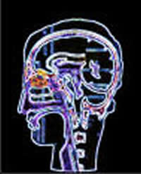 Περίγραμμα ανατομίας ανθρώπινου κρανίου-εγκεφάλου