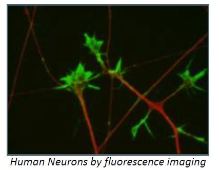 Ανθρώπινοι νευρώνες σε φωτογραφία φθορισμού