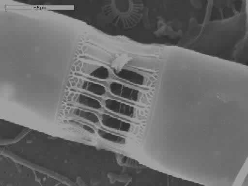 Διάτομο skeletomena costatum σε ηλεκτρονικό μικροσκόπιο σάρωσης